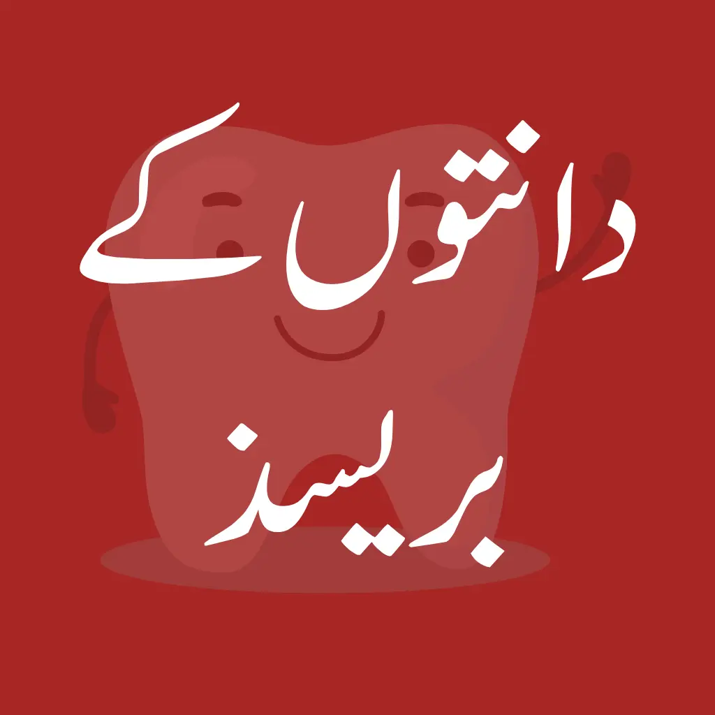 Dental-Braces-Mashhooddentalcare-sheikupura-دانتوںمعائنہ