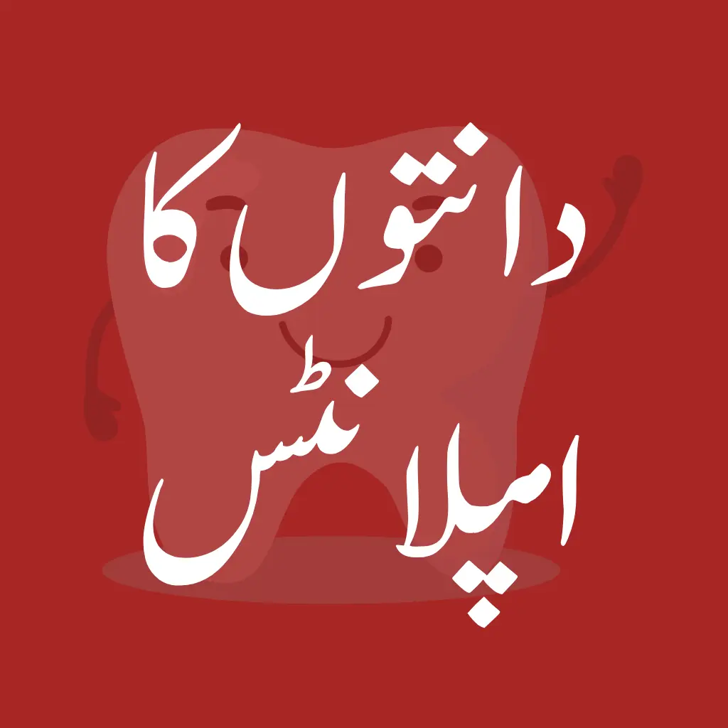 Dental-implants-Mashhooddentalcare-sheikupura-دانتوںمعائنہ