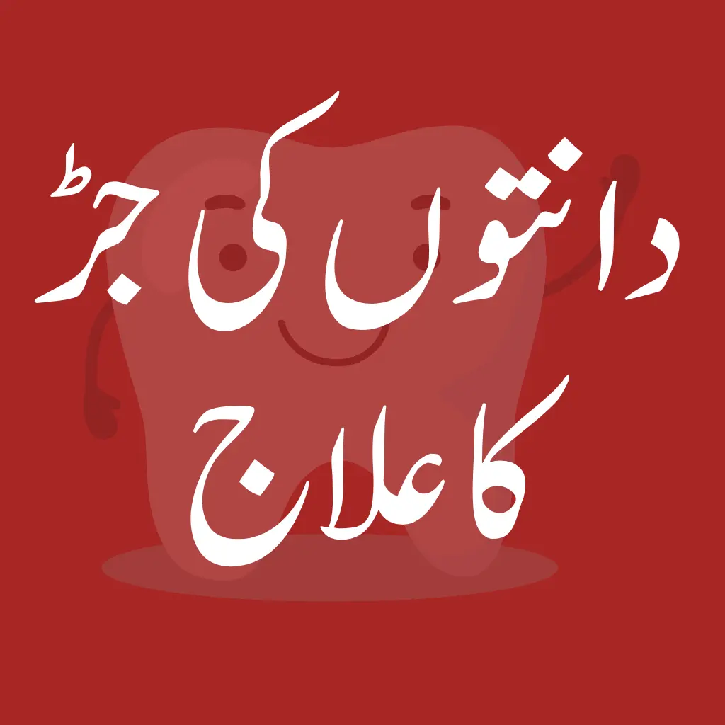 Rootcanal-Mashhooddentalcare-sheikupura-دانتوںمعائنہ